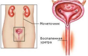 Запах детской мочи