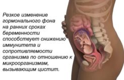 Цистит во время беременности, причины развития