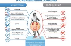 Лечение мочекаменной болезни у женщин