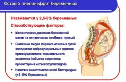 Пиелонефрит и беременность — причины, симптомы и лечение